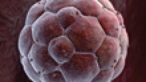 cyst.jpg